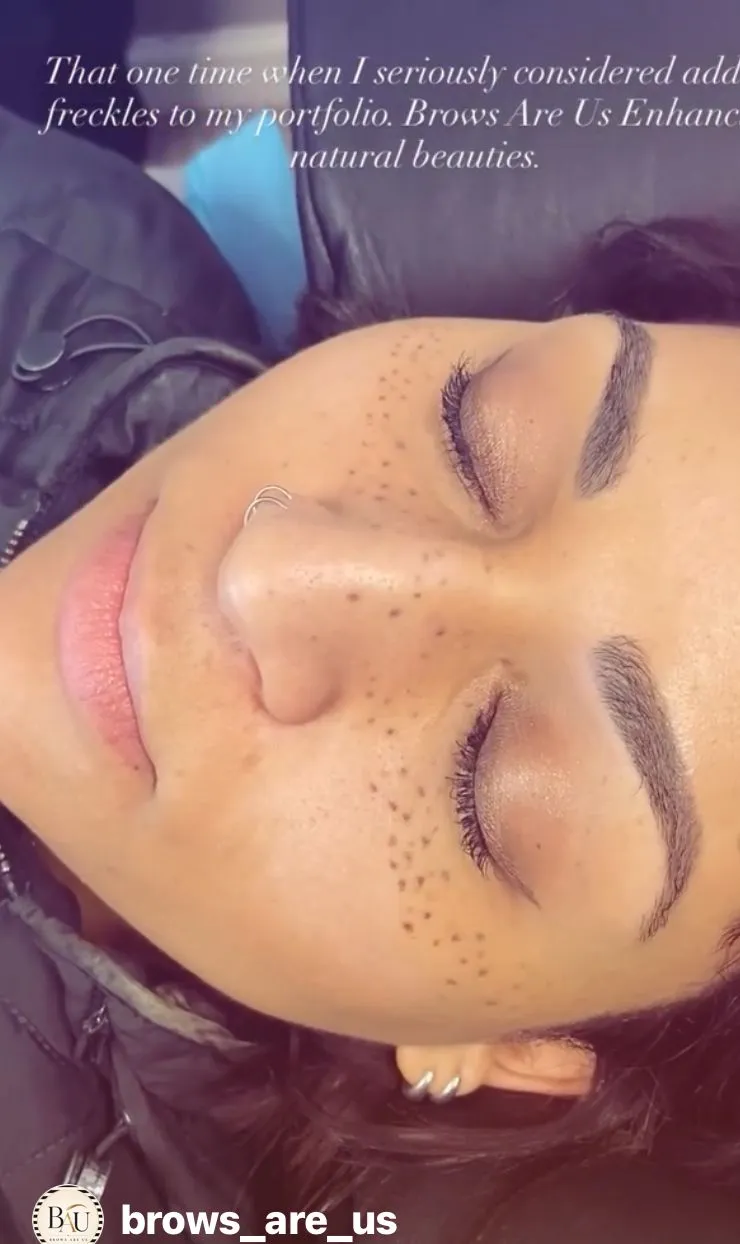 Close-up collage showing freckles across the bridge of a person’s nose and cheeks.